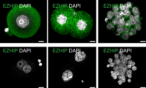  H3K27me3-dependent imprinting and transcriptional regulation in early mouse embryosrequiresEZHIP-mediated restriction of PRC2 activity 